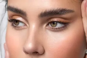 جراحی چشم گربه_ ای طبیعی