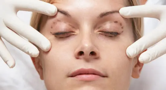 درمان های پزشکی افتادگی پلک