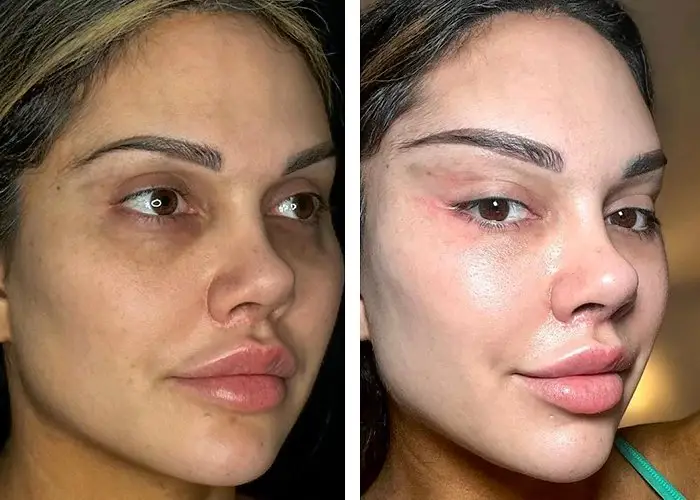 چشم گربه_ای