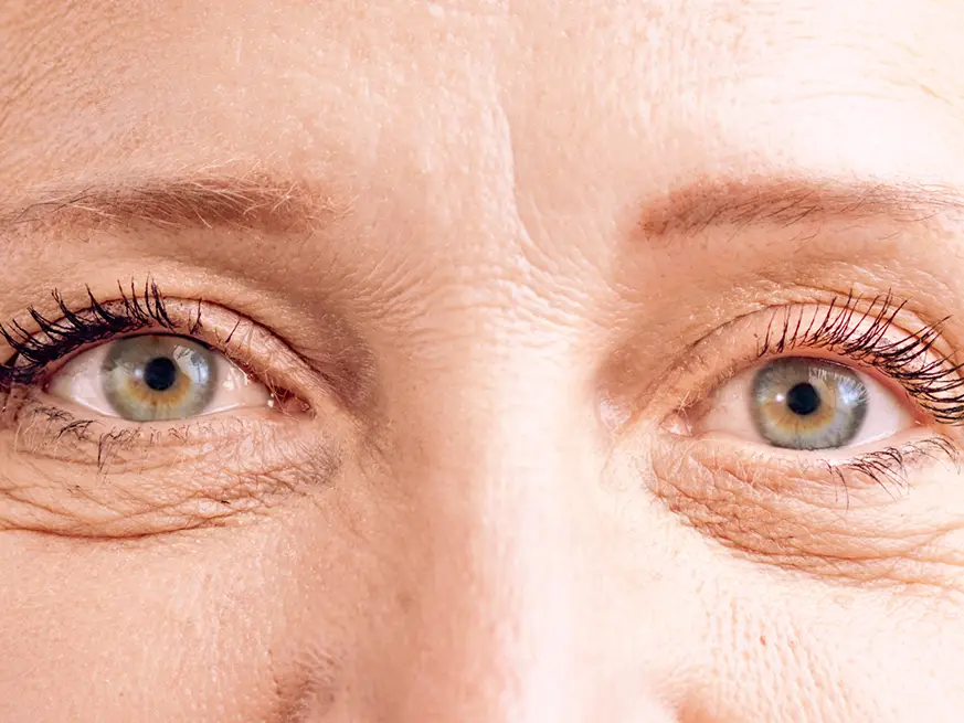 چطور از افتادگی پلک جلوگیری کنیم؟