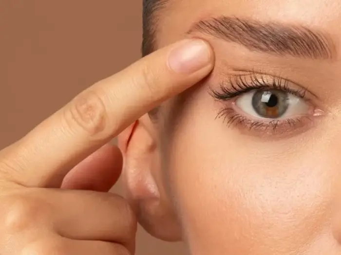 بلفاروپلاستی پلک بالا