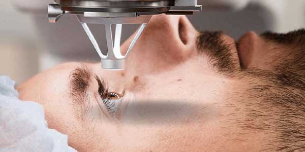 بهترین سن برای عمل لیزیک چشم چه زمانی است؟